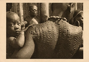 Bamum Woman - Cameroon - Extensive back scarification Bamum Woman - Cameroon - Extensive back scarification