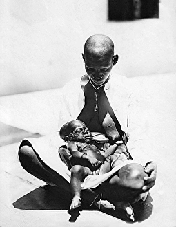 Child with Yaws, Mombasa, Kenya, East Africa Child with Yaws, Mombasa, Kenya, East Africa