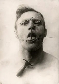 A German Fakir - man undergoing extreme accupuncture A German Fakir - man undergoing extreme accupuncture