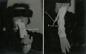 Helen Duncan Ectoplasm & Teleplasmic Hand Print