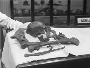 Medical Anatomy Prints: Human Bones