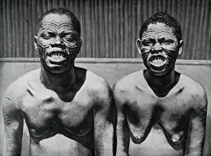 Ornamental scars on face and sharpened and filed teeth Ornamental scars on face and sharpened and filed teeth
