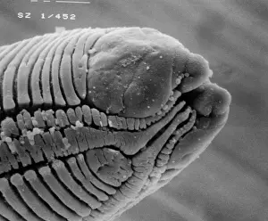 Scanning Electron Micrograph SEM Prints: Roundworm