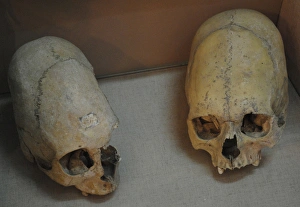 Sarmatians. Deformed human skulls. Probably dated in the 3rd Sarmatians. Deformed human skulls. Probably dated in the 3rd