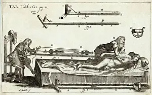 Medical Illustration Art Prints: Setting a Bone 1682