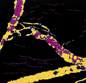 Scanning Electron Microscope Image Prints: Silver