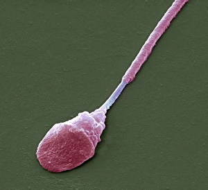 Framed Print : Abnormal sperm Print, SEM image at x8000 magnification Framed Print : Abnormal sperm Print, SEM image at x8000 magnification