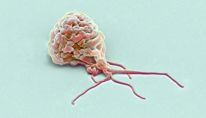 Immune System Cells SEM Prints: Activated granulocyte, SEM