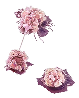 Immune System Cells SEM Prints: Activated granulocytes, SEM