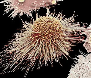 Activated macrophage, SEM C015/6375 Activated macrophage, SEM C015/6375