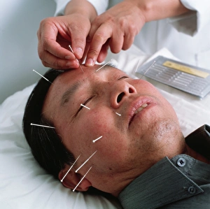 Acupuncture Print: Man receiving facial treatment