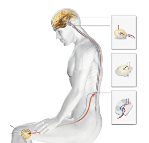 Acupuncture Print