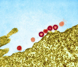 AIDS virus particles budding from a cell Print, TEM image