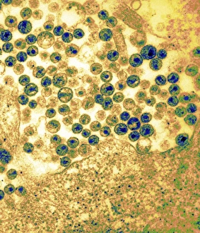 Images Dated 23rd May 2006: AIDS virus particles budding from a cell, Print