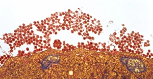 AIDS viruses budding from T-cell AIDS viruses budding from T-cell