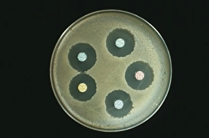 Anthrax antibiotics research Anthrax antibiotics research