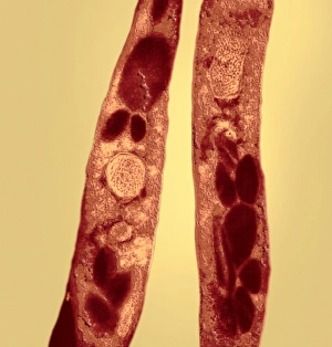 Transmission Electron Micrograph Prints: Anthrax bacteria, TEM