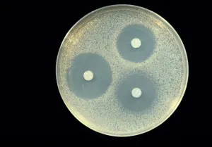 Antibiotics research Antibiotics research