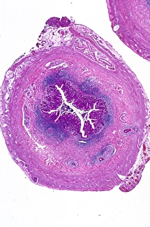 Prints of Appendix. Light micrograph of a section through a human appendix. The appendix is a blind-ending small diameter tubular extension of the gut, arising from the caecum of the large bowel Images Dated 2013 May: Appendix Light Micrograph Print
