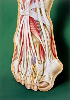 Art of a human foot showing various disorders Art of a human foot showing various disorders