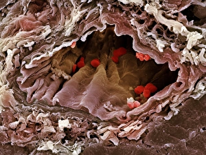 Artery SEM Artery SEM