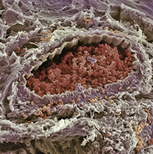 Prints of Artery. Coloured scanning electron micrograph (SEM) of a sectioned artery containing red blood cells (erythrocytes, red). Arteries carry oxygenated blood to the bodys tissues Images Dated 2003 October: Coloured SEM Print of a Sectioned Artery
