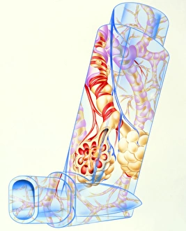 Artwork of asthmatic respiratory system on inhaler Artwork of asthmatic respiratory system on inhaler