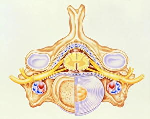 Artwork of cervical vertebra from human spine Artwork of cervical vertebra from human spine