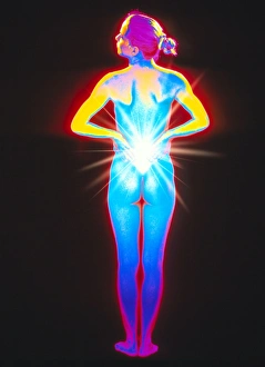 Artwork depicting back pain in a woman Artwork depicting back pain in a woman
