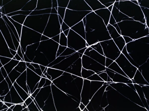 Artwork of elastin fibre network in human skin Artwork of elastin fibre network in human skin