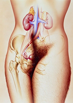 Artwork of hirsutism of a womans body Artwork of hirsutism of a womans body