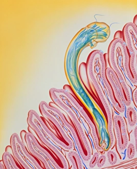Artwork of hookworm clinging to intestinal lining Artwork of hookworm clinging to intestinal lining