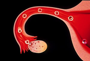 Artwork of human fertilisation and implantation Artwork of human fertilisation and implantation