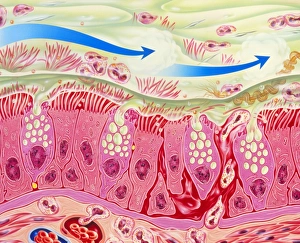 Artwork of inflamed bronchial epithelium in asthma Artwork of inflamed bronchial epithelium in asthma