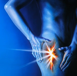 Artwork of a man holding his thigh in pain Artwork of a man holding his thigh in pain