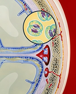 Artwork of meninges & bacteria showing meningitis Artwork of meninges & bacteria showing meningitis Artwork of meninges & bacteria showing meningitis Artwork of meninges & bacteria showing meningitis