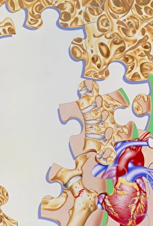 Artwork of menopause: osteoporosis, heart disease Artwork of menopause: osteoporosis, heart disease