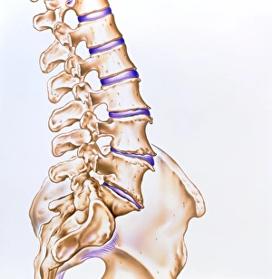 Artwork of osteoarthritis of the spine Artwork of osteoarthritis of the spine