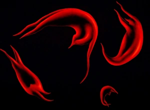 Artwork of red cells in sickle cell disease Artwork of red cells in sickle cell disease