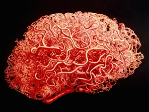 Artwork showing the blood vessels of the brain Artwork showing the blood vessels of the brain