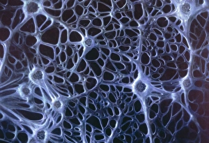 Artwork showing numerous multipolar neurones Artwork showing numerous multipolar neurones