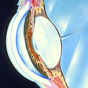 Artwork of the structure of the front of an eye Artwork of the structure of the front of an eye