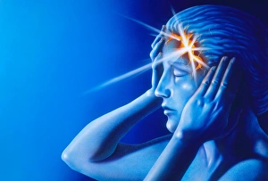 Artwork of woman with head split showing headache Artwork of woman with head split showing headache