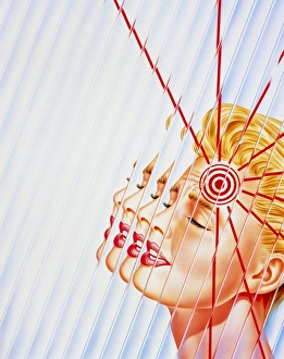 Artwork of woman suffering a headache or migraine Artwork of woman suffering a headache or migraine