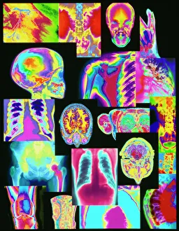 Assortment of coloured X-rays and body scans Assortment of coloured X-rays and body scans