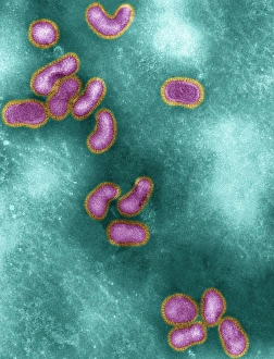 Avian influenza virus, TEM Avian influenza virus, TEM
