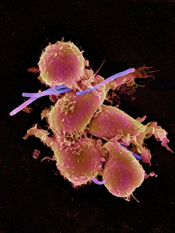 Bacteria infecting macrophage cells, SEM Bacteria infecting macrophage cells, SEM