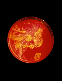 Medical Microbiology Prints: Bacterial colonies