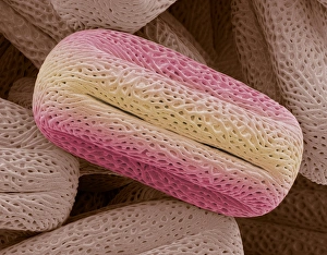 Pollen Grain Morphology Prints: Bay tree pollen, SEM