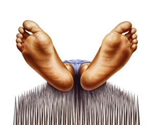 Alternative Healing Methods Prints: Bed of nails, artwork